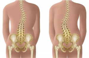 durere fulgerătoare în coloana vertebrală